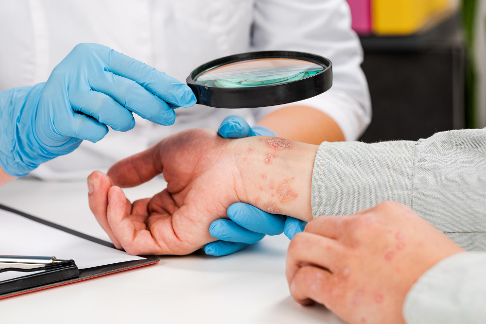 Treatment for dermatological disease